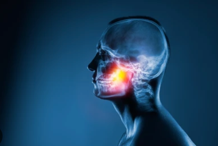 Rendering of a human skull with the jaw joint and surrounding musculature highlighed in bright colors.