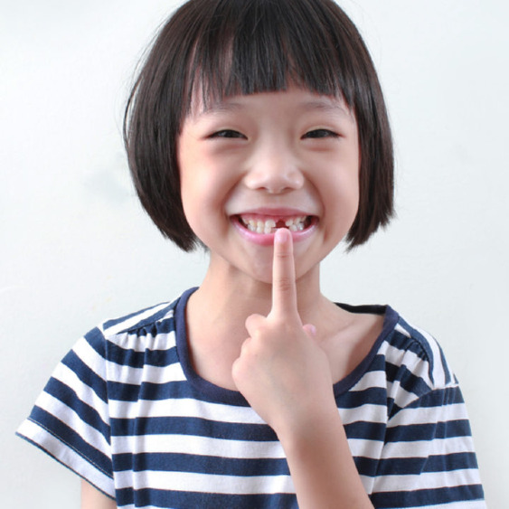 Asian child in a black and white striped t-shirt points to a space left behind from a lost tooth.